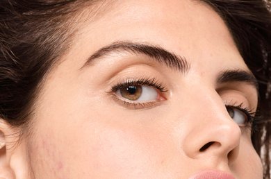 hva-er-hormonell-uren-hud-og-hvordan-kan-hudpleie-hjelpe